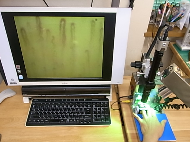 採決なしで、毛細血管の状態を観察！