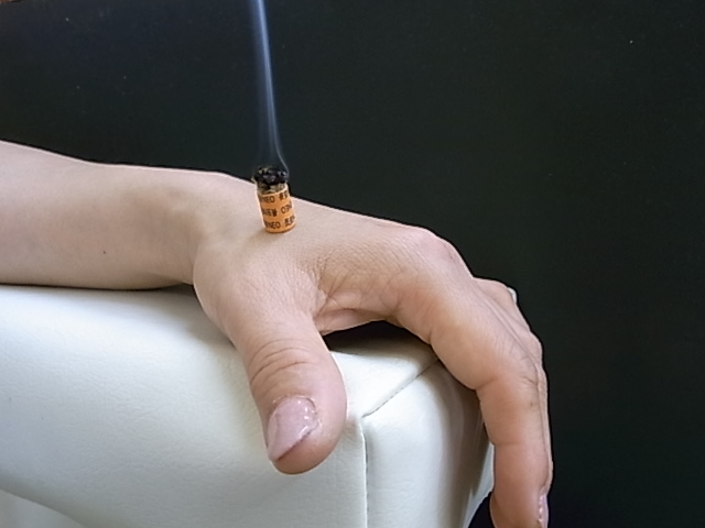肩こりのツボ、痕のつかない心地よいお灸です。