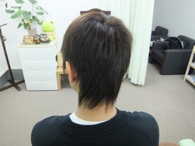 寝違えで動かない首…。施術後はこちら→http://kaeru0730.web.fc2.com/case8.html