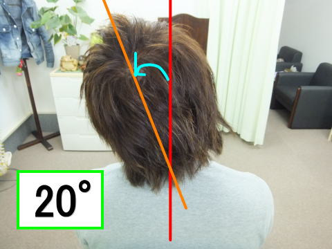 頭を左に倒すと20°しかない可動域…（理想は50°）　施術後どのような変化が？！→http://kaeru0730.web.fc2.com/straightneck.html